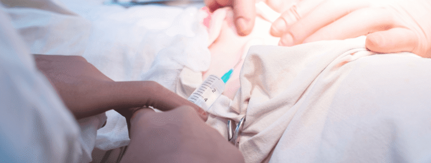 Understanding Soft‑Tissue Injuries After a Rear‑End Collision in South Carolina